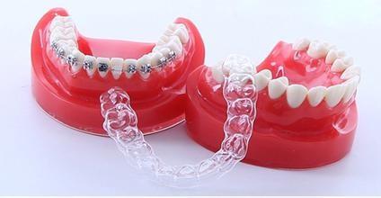 矫正牙齿戴哪种牙套好?
