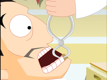 阻生牙拔除多少钱